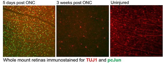 Post ONC Illustration